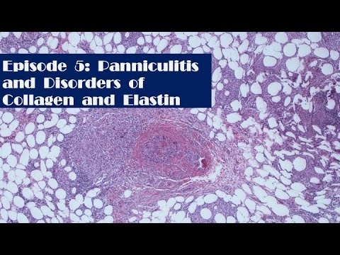 Episode 5: Panniculitis and Disorders of collagen and elastin