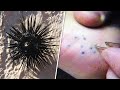 15 Most Painful Animal Stings You Can Experience