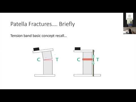 Patella Fractures - Dr. Lim
