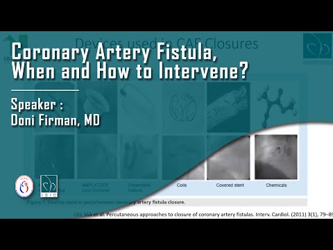 Coronary Artery Fistula - When and How to Intervene?