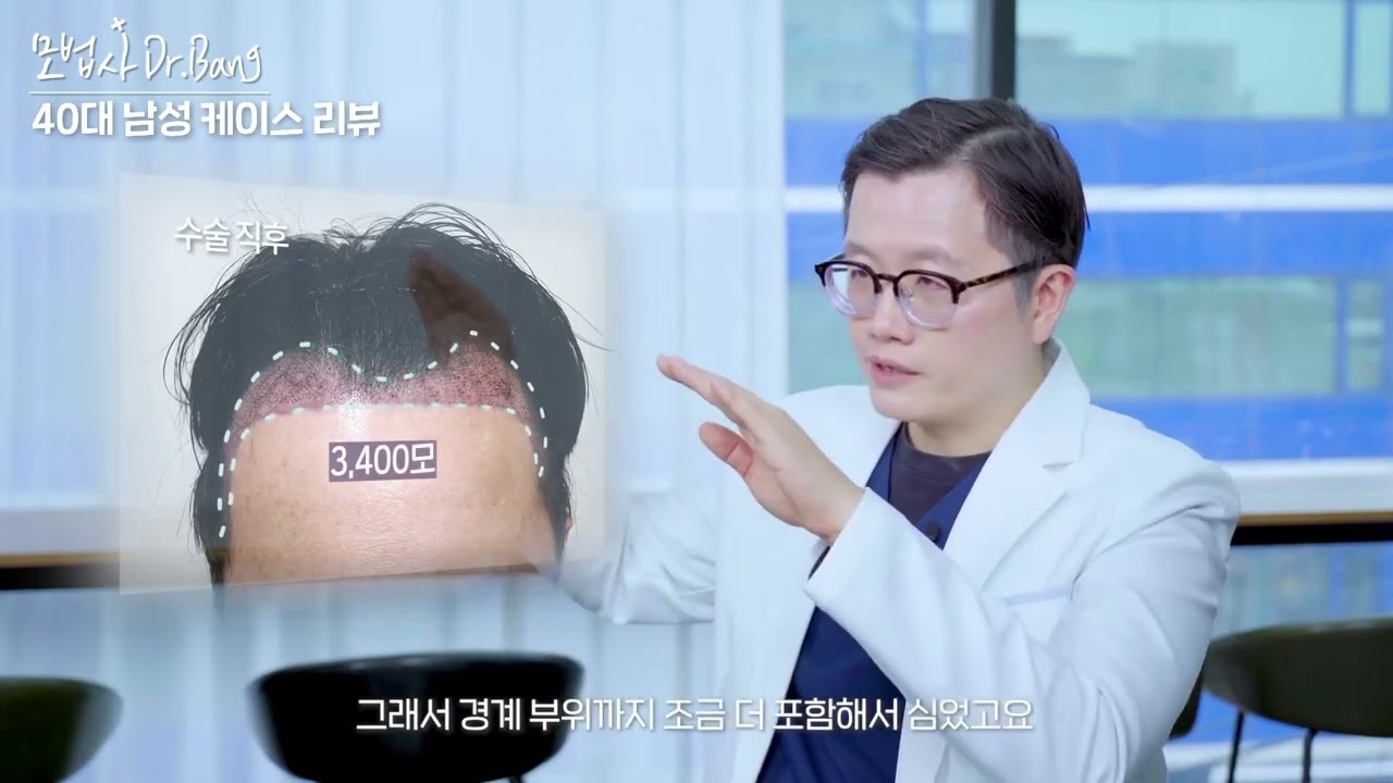 Real Case: Restoring an M-Shaped Hairline_DR.Bang