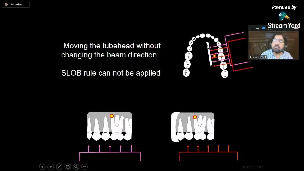 Tube Shift Technique Clark or SLOB Rule Lecture By Prof. Dr Arshad