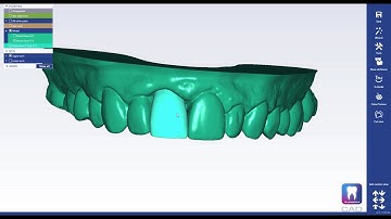 How to create a printable wax-up model in Planmeca PlanCAD® Premium