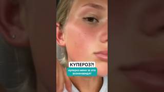 Заказать Куперофаг можно на Wildberries. Артикул -  430726835