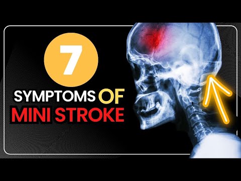 7 Symptoms Of Mini Stroke - Transient Ischemic Attack Signs