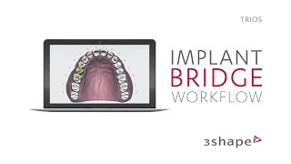 3Shape TRIOS - Implant Bridge Workflow