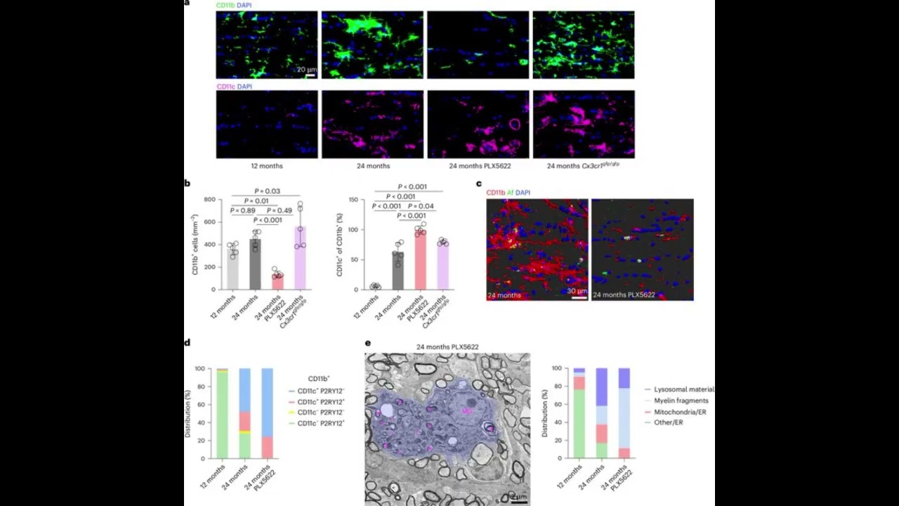 Microglia, T Cells, and White Matter Degeneration: Unraveling the Mechanisms of Aging in the Brain