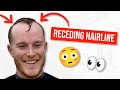 How to cut a Receding Hairline 👴🏼