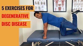 Top 5 Lower Back Degenerative Disc Disease Exercises