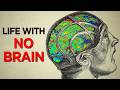 The Man Who Lived with No Brain