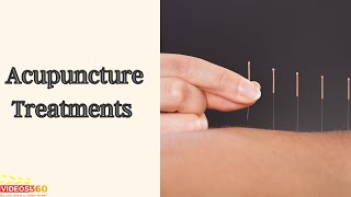 Dr. Robert Kachko discusses acupuncture treatments at NY Center For Integrative Health