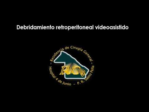 Debridamiento retroperitoneal video asistido camera iphone 8 plus apk