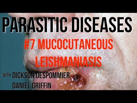 Video: Hoe spreek je mucocutane leishmaniasis uit?