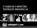 5 Cases in 5 Minutes: Thoracic #5