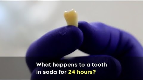 What happens to a tooth in soda for 24 hours?