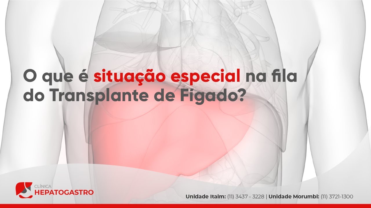 O que é situação especial na fila do Transplante de Fígado? | Clínica ...