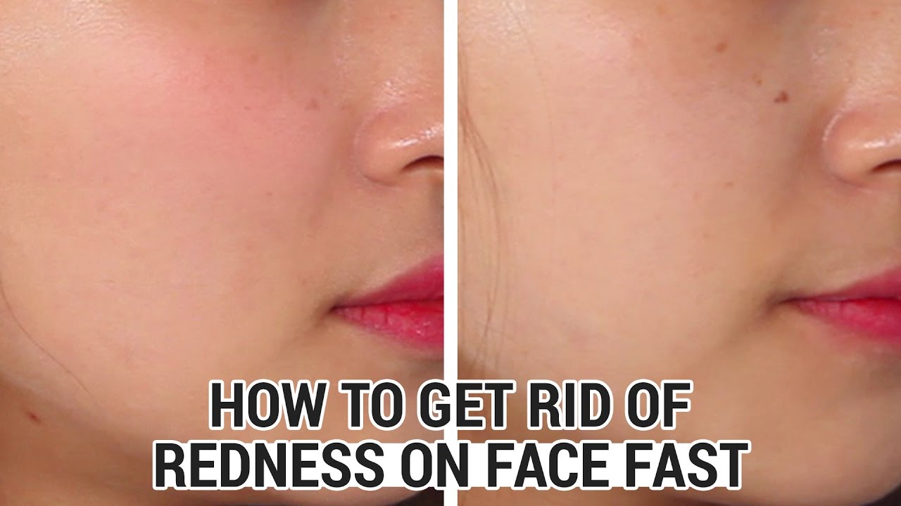 Redness fast skin reduce How To