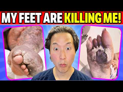 Doctor Reacts to MY FEET ARE KILLING ME! Compilation