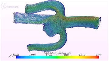 Blood particle flow in an aneurysm - a simulation in StarCCM+ (60fps)