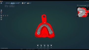 UP300E - Scanning impressions with wax-bite