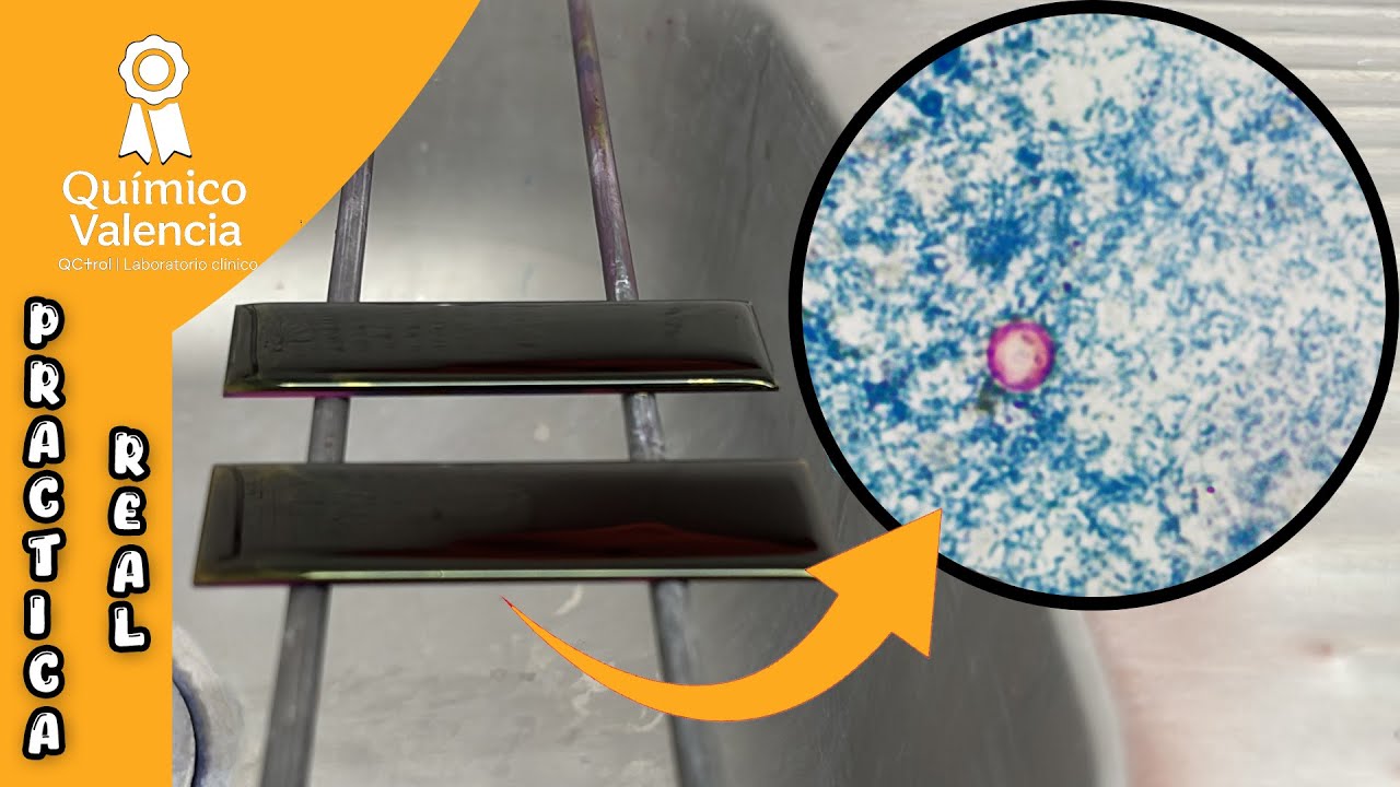 Пошаговое окрашивание по Киньюну | Лабораторная диагностика кишечных кокцидий 🔬