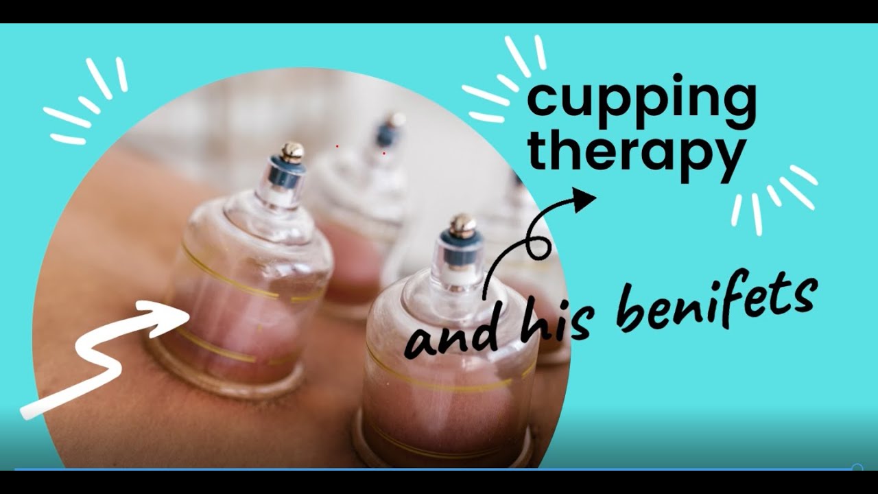 What Is Cupping? The Effects and Benefits YouTube