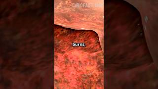Burn Damage - Acid Rain