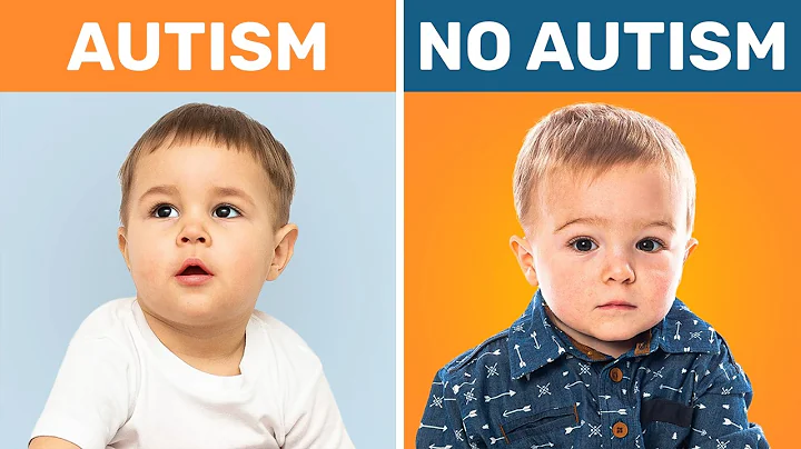 10 Subtle Signs Of Autism Most Parents Miss