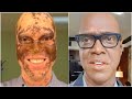 TV Reporter Paints His Skin Every Day To Save His Career