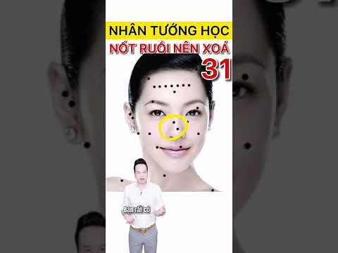 Video: Một nốt ruồi toán học là gì?