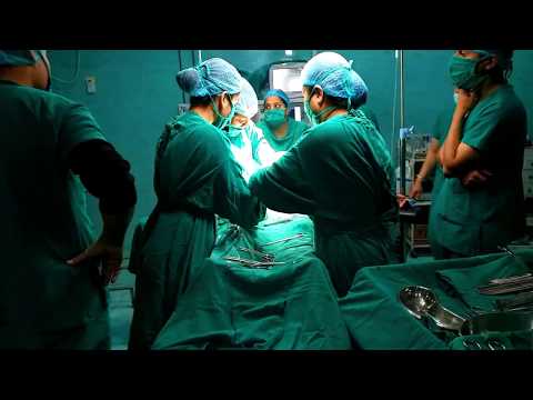 cesarean-section-delivery