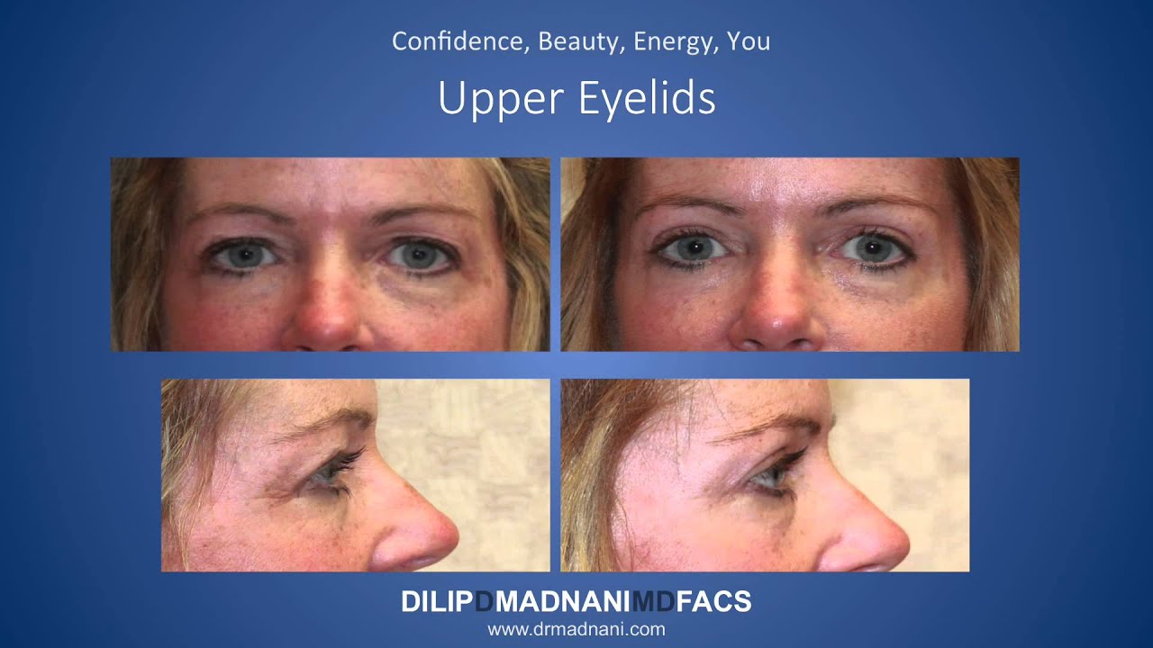 Manhattan Plastic Surgery Before and After Results YouTube