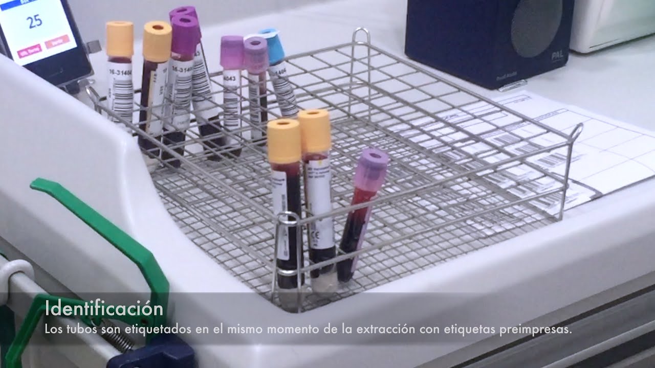 Albumina en orina al azar valores normales