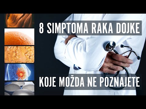 Video: Ali je razbarvanje znak raka dojke?