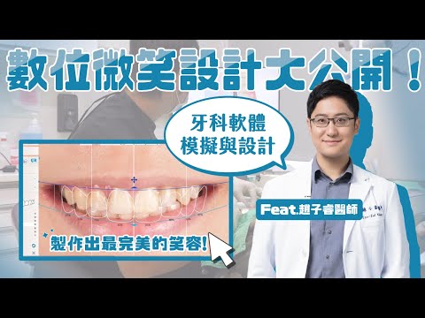 你所不知道的數位微笑設計揭密！牙科也能事先模擬與設計 Ft.趙子睿醫師【品悅牙醫】