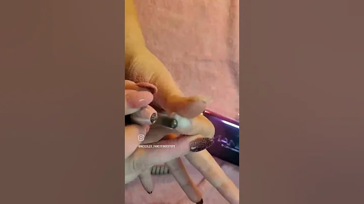 Nail Reduction and Prep for Balance