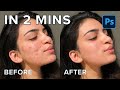 How to remove pimples in Photoshop [Under 2 mins]