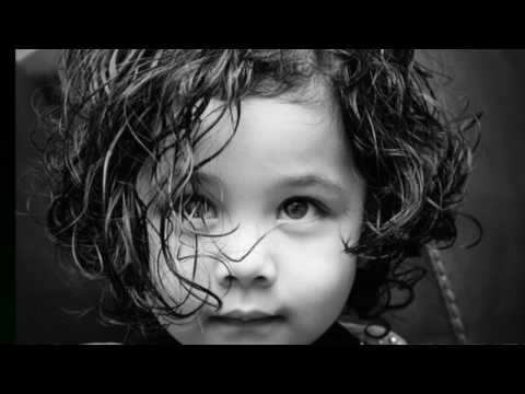 Vídeo: Pérdida De Cabello En Niños: Causas Y Tratamientos