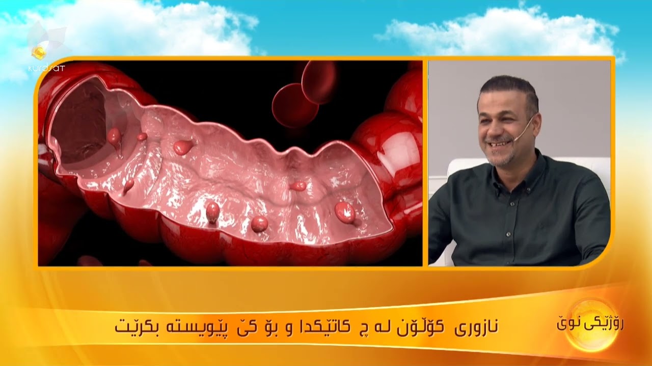 نازوری كۆڵۆن لە چ كاتێكدا و بۆ كێ‌ پێویستە بكرێت