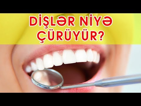 Video: Niyə Dişləri çəkmək Onları çıxarmaq Kimi Deyil