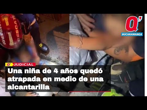 ¡Qué angustia! Así fue el rescate de la piernita de una niña de solo 4 años, la cual se le quedó ato