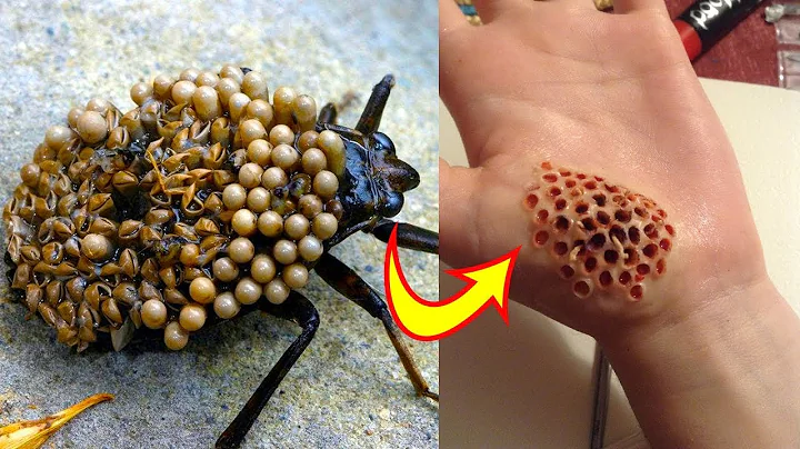 10 Most Dangerous Bugs In The World - DayDayNews