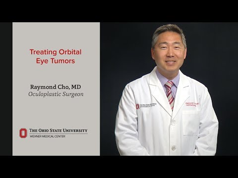 Treating orbital eye tumors | Ohio State Medical Center