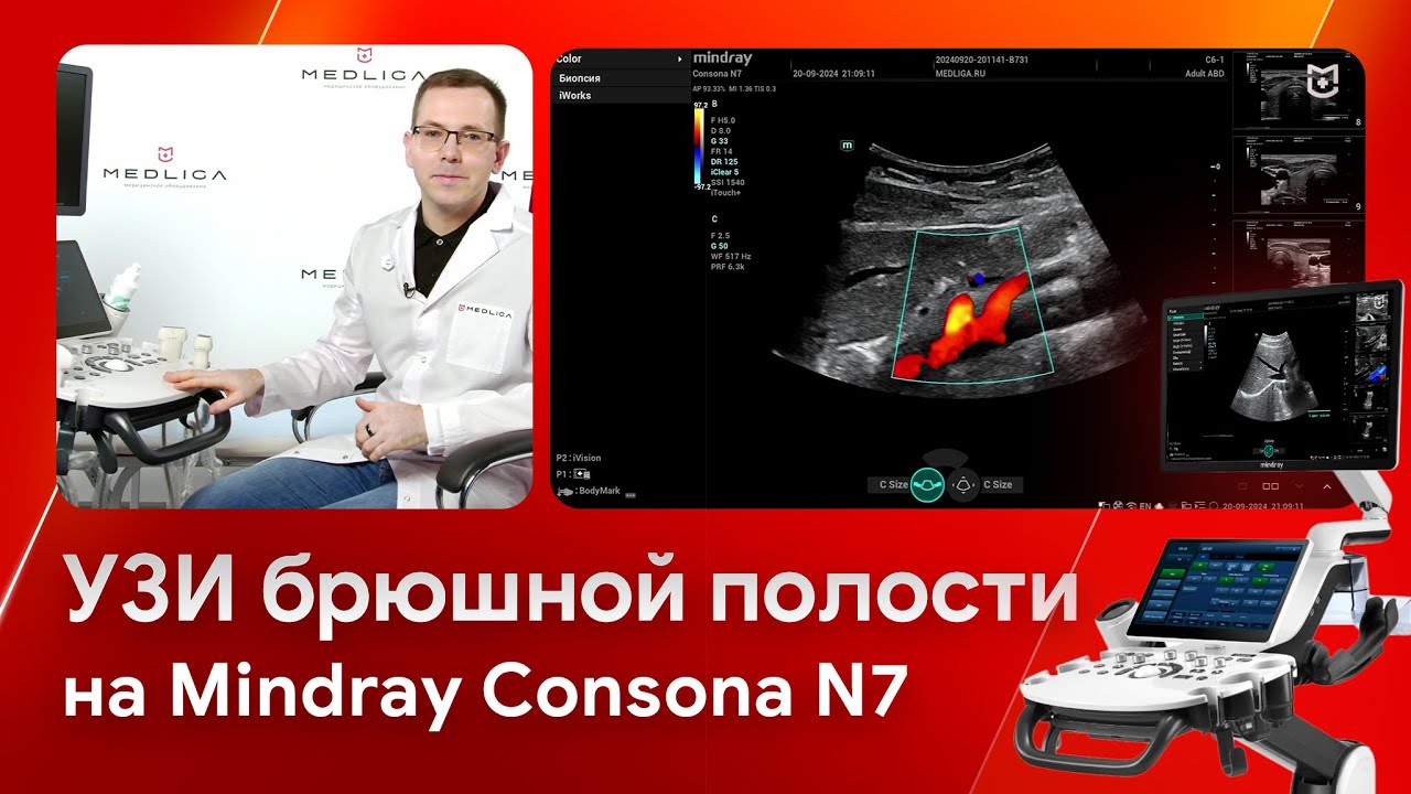 УЗИ брюшной полости и оценка жирового гепатоза на Mindray Consona N7
