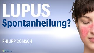 Lupus Erythematodes Besiegt? Einblicke In Eine Spontanheilung - Philipp Domsch