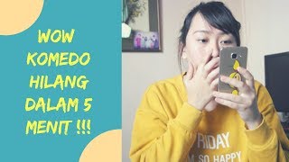 Cara Menghilangkan Komedo Skincarealami