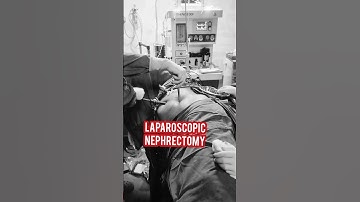 Laparoscopic nephrectomy