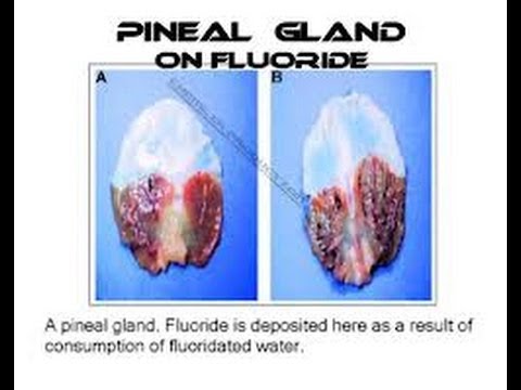 pineal gland fluoride does flouride calcification effects body floride remove damage calcify reverse eye water 3rd decalcify tooth iodine