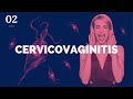 Cervicovaginitis - ENARM  (Clase Patreon)