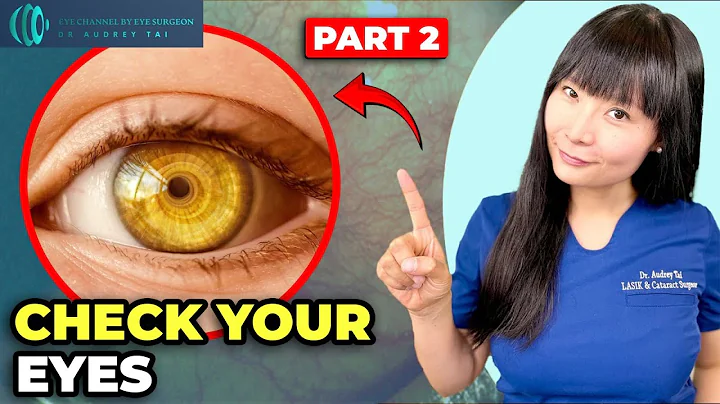 20 Hidden Diseases Revealed by Eye Exams | Part 2| Eye Surgeon Explains #draudreytai